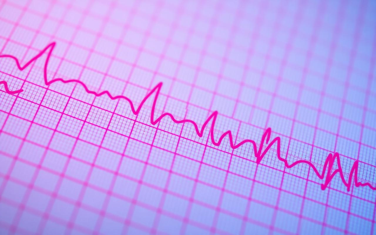 Tira de ECG